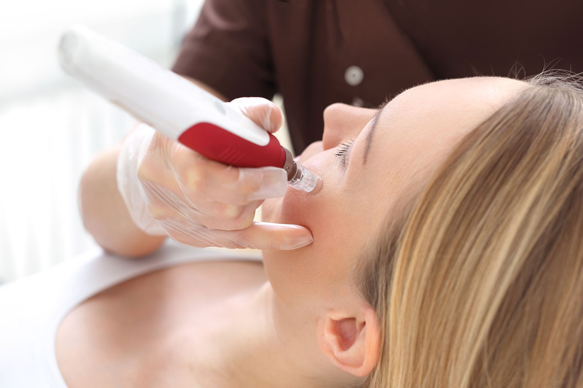 dermapen
